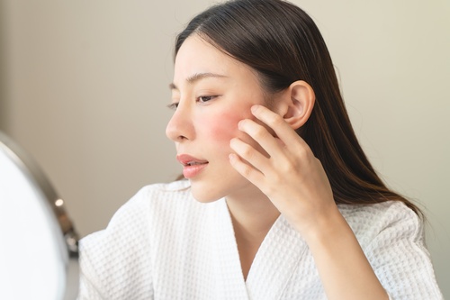 Pelle Sensibile in Primavera: Cause e Skincare Lenitiva